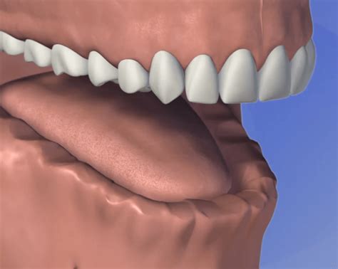 Dental Dentures Stonehill Dental Hamilton Dentist