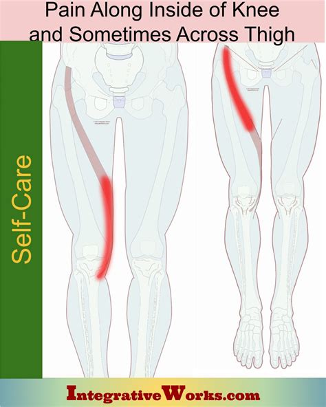 Self Care Pain Inside Of Knee Sometime Across Thigh Integrative