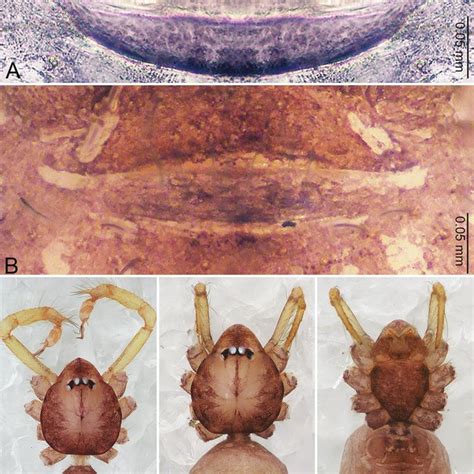 Merizocera Colombo Sp Nov Holotype Male And Paratype Female A