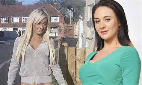 Josie Cunningham Had £5000 Breast Implants On The Nhs And Now She