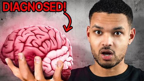 My Brain Scan Revealed Adhd Heres The Truth Ep13 Youtube