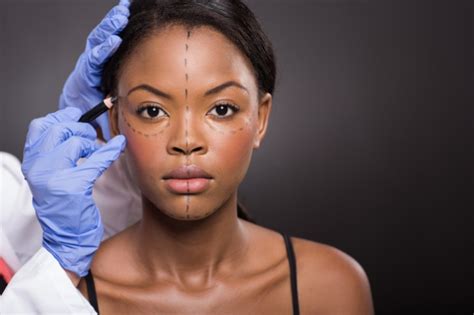 Disadvantages Of Plastic Surgery Blackdoctor