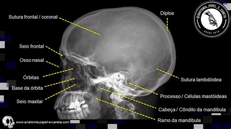 Anatomia Radiol Gica Do Cr Nio Anatomia Papel E Caneta