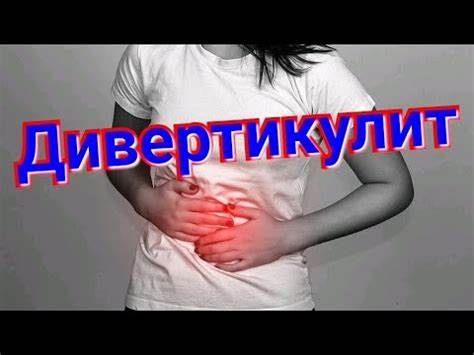 Дивертикулит диета меню Дивертикулит Симптомы - YouTube Дивертикулит Симптомы - YouTube Дивертикулит диета меню