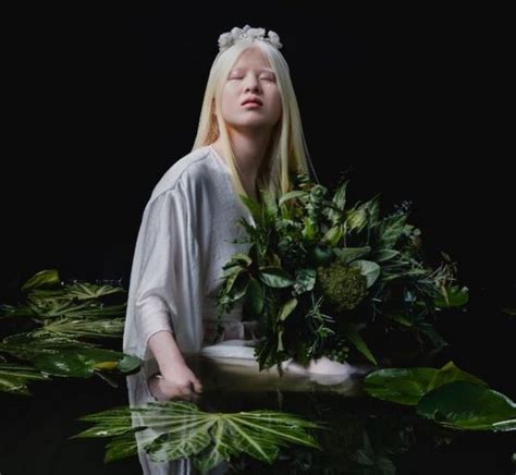 Albino Alasannya Di Buang Orangtuanya Namun Kini Jadi Model Vogue