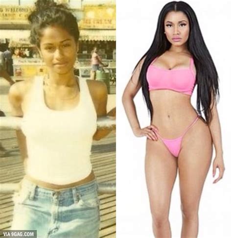 Nicki Minaj Before And After Plastic Surgery 9gag