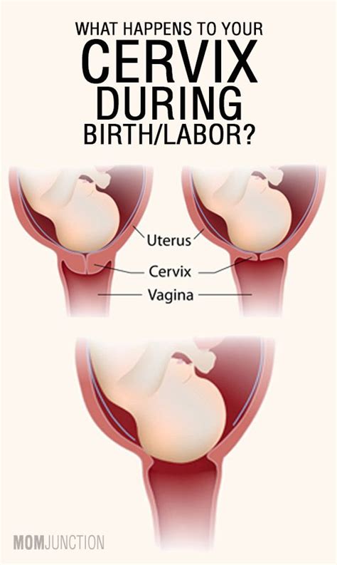 Things You Didnt Know About Labor Cervix Dilation
