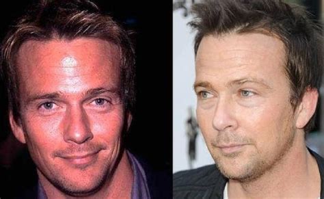 Sean Patrick Flanery Rumors Of Plastic Surgery On His Face