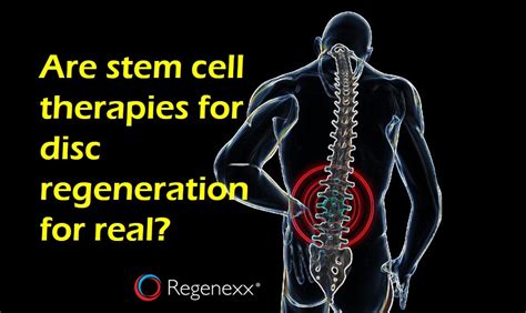 Stem Cells For Disc Regeneration