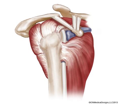 What are common rotator cuff injuries. Anatomy of the Shoulder Archives - Joint Preservation Center