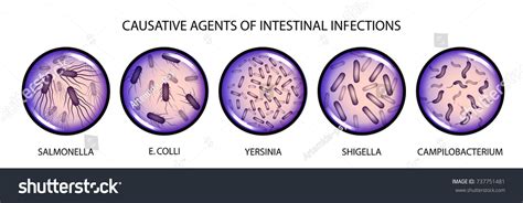 Vector Illustration Causative Agents Intestinal Infections Stock Vector