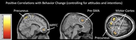 Mri Scans Are Better At Predicting Your Behavior Than You Are