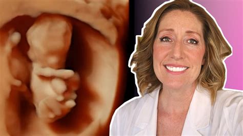 Month By Month What To Expect On Your Pregnancy Ultrasound Youtube