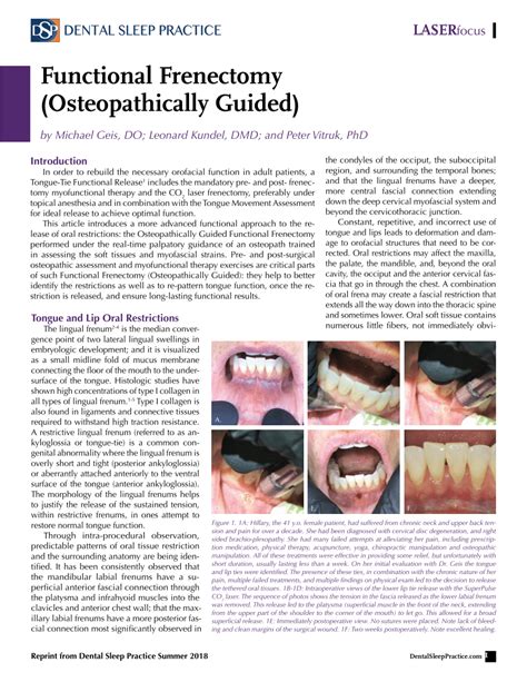 Pdf Functional Frenectomy Osteopathically Guided