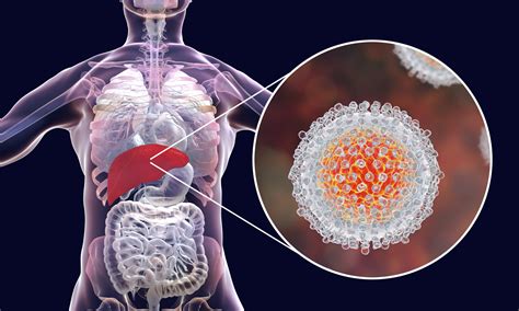 The Viral Time Bomb Hepatitis C Where Wellness