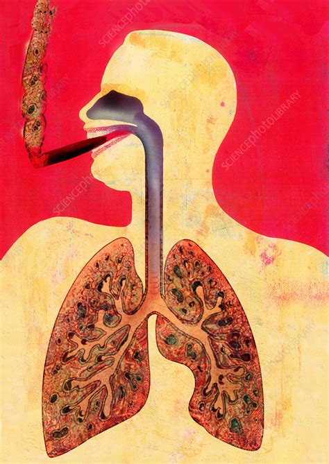 smoking and lungs stock image m370 1033 science photo library