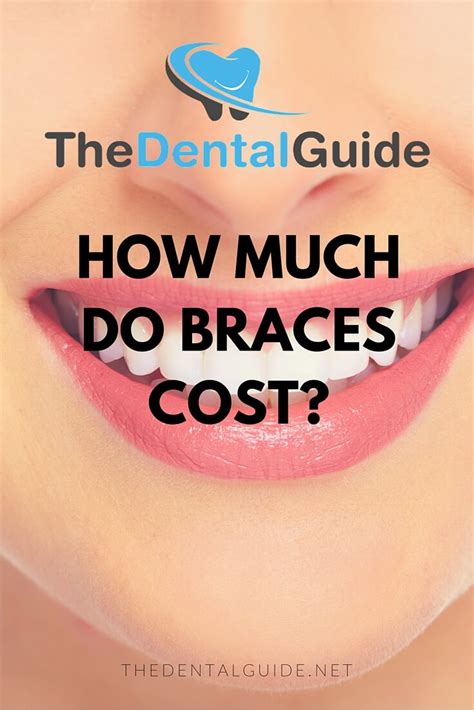 How Much Do Braces Cost In The Uk The Dental Guide Uk