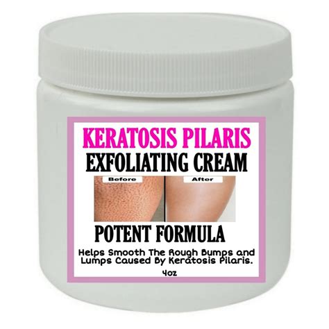 Strawberry Legs Exfoliating Cream Potent Formula Etsy Uk