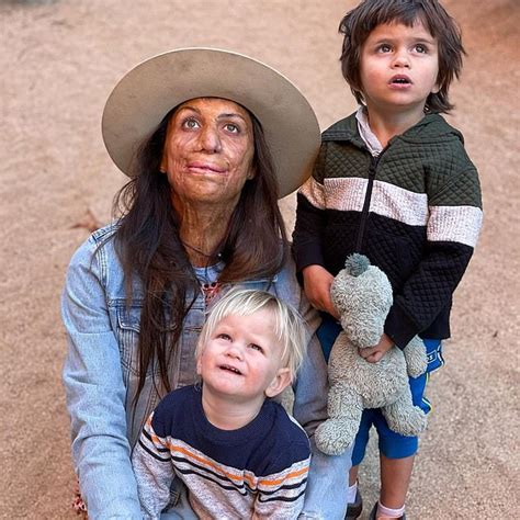 Burns Survivor Turia Pitt Reveals She Panicked After Falling Pregnant Daily Mail Online