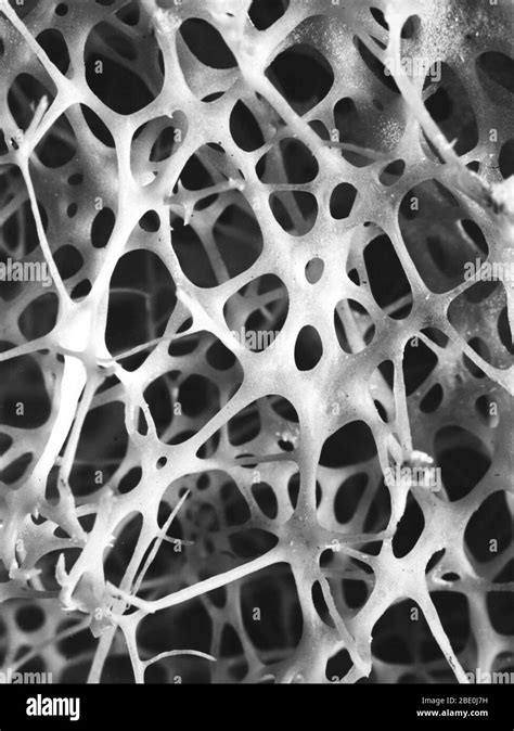 Cancellous And Compact Bone Hi Res Stock Photography And Images Alamy
