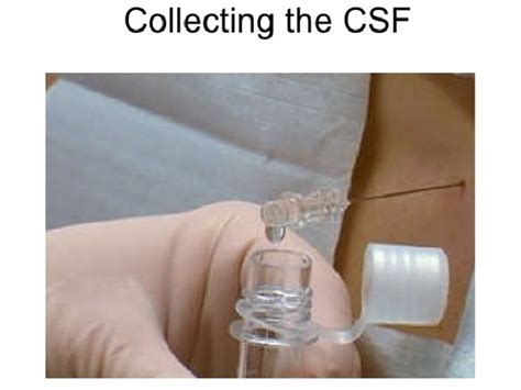 Lab 5 Cerebrospinal Fluid Csf Part I Introduction