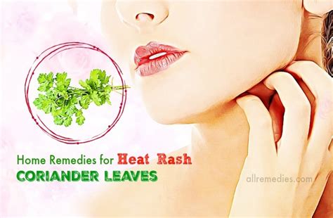Top 23 Natural Home Remedies For Heat Rash Causes And Treatments