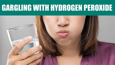 Benefits And Side Effects Of Gargling With Hydrogen Peroxide Youtube