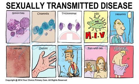 Illustrationstd 3508×2126 Sexually Transmitted Diseases