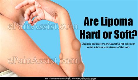 Are Lipomas Hard Or Soft Subcutaneous Tissue Skin Diseases Skin
