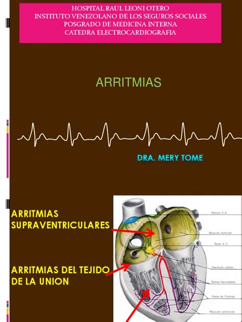 Arritmias Seminario Dr Pedro Pdf Arritmia Cardiaca Fisiología