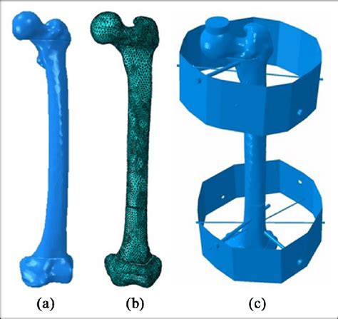 Femur 3d Numerical Model A Obtained Geometry From Medical Images B
