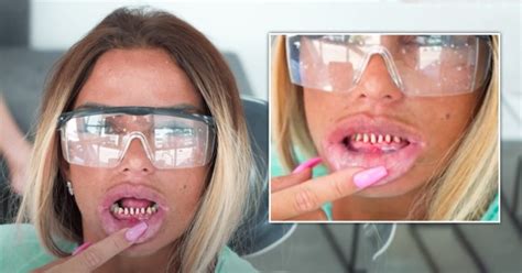 All her teeth are damaged with a cavity. Katie Price 'terrified' as teeth fall out before vacation ...