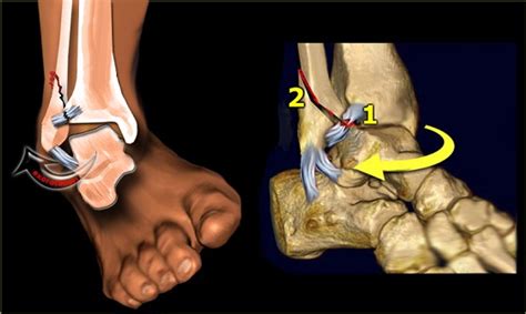Study Medical Photos: Terminology For Different Types Of ...