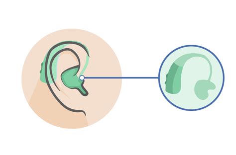 Types Of Hearing Aids Explained