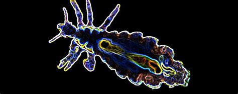 Super lice invade Indiana - Head Lice Treatment ...