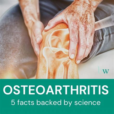 Osteoarthritis 5 Facts Based On Science The Bodyworks Clinic