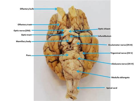 Brain Images Labeled