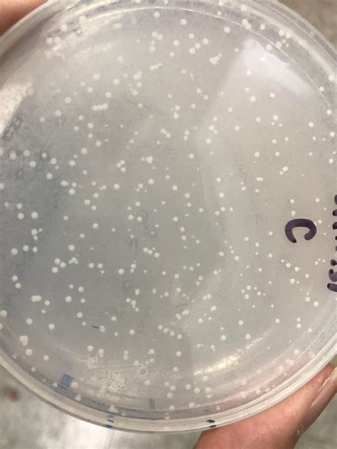 Why I Get Various Size Of Colony In Yeast Transformation Researchgate