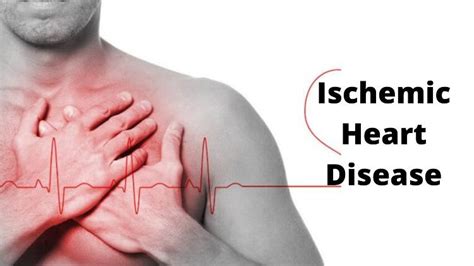 What Is Ischemic Heart Disease Types Treatment And Risk Factors