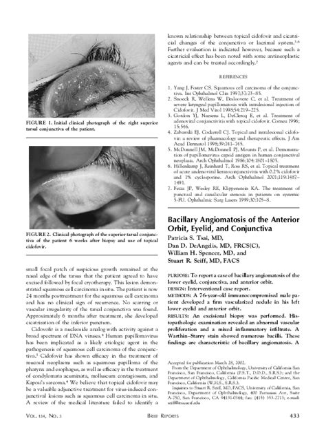 Pdf Bacillary Angiomatosis Of The Anterior Orbit Eyelid And