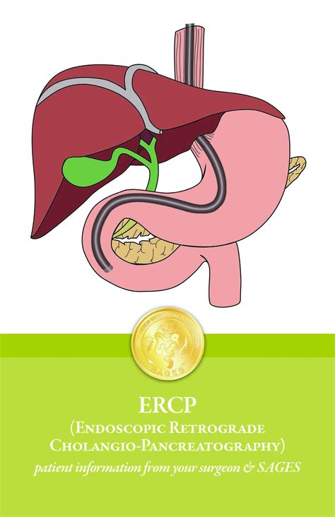 Ercp Endoscopic Retrograde Cholangio Pancreatography Patient