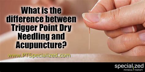 Types Of Acupuncture