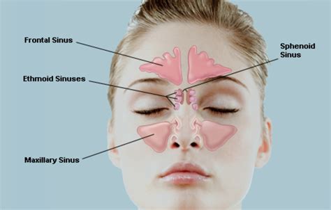 Maxillary And Ethmoid Sinus Disease