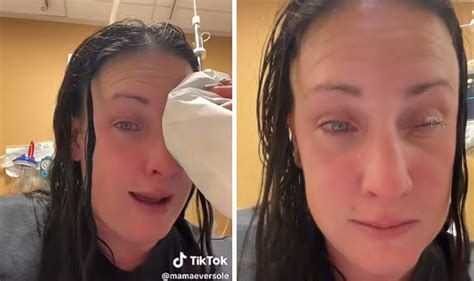 Woman Accidentally Superglues Eye Shut After Mistaking Bottle Of Nail