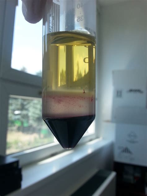 It is prepared by reaction of the polysaccharide with epichlorohydrin. Could anybody help me? What is the problem with my ...