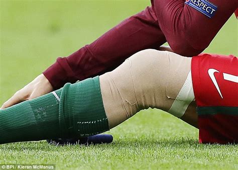 Cristiano Ronaldo Suffers Knee Injury In Euro 2016 Final Daily Mail