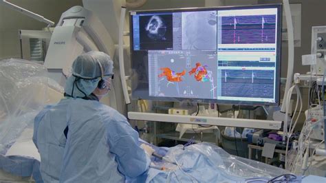 Complex Ablation Procedure Broadcastmed