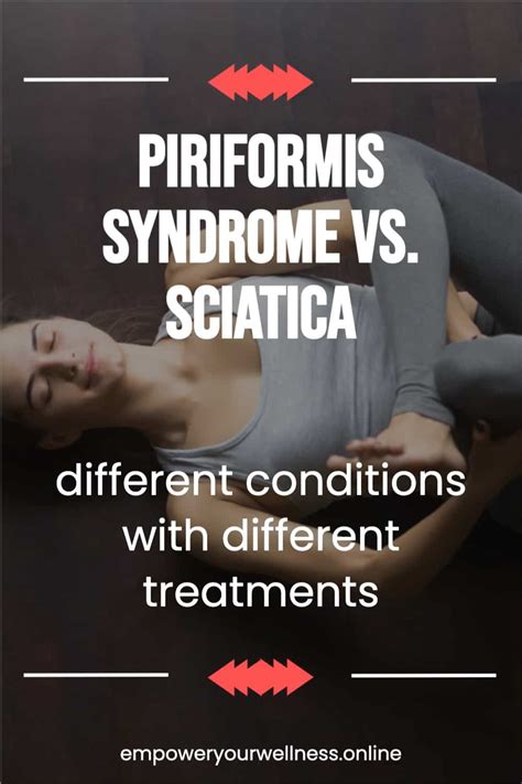 Piriformis Syndrome Vs Sciatica What To Know Empower Yourwellness Porn Sex Picture
