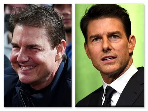 What Happened To Tom Cruises Face Pm News