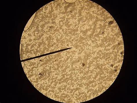 Yeast Cells Under The Microscope Characteristics Habitat Observation